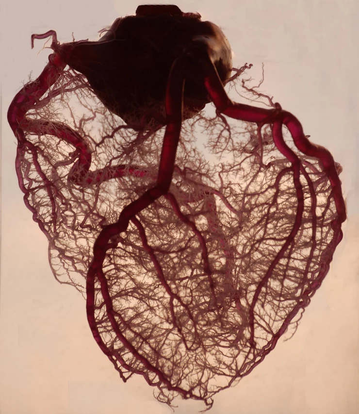 心臓の血管