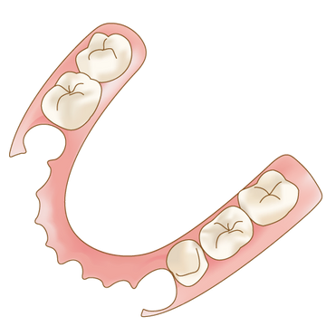 針金のないノンメタルクラスプ義歯